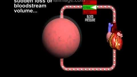 Shock Animation by Cal Shipley, M.D.