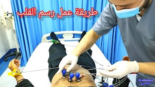 طريقه عمل رسم القلب ECG