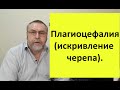 Плагиоцефалия (нарушение формы черепа). Почему возникает и что можно сделать.