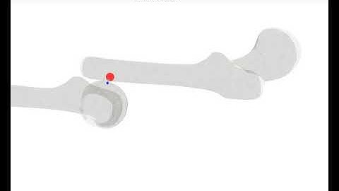 Stable 6-DOF Haptic Rendering with Inner Sphere Trees (Bones)