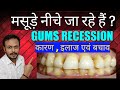 मसूड़े के नीचे जाने का इलाज || Gums Recession Causes ,Treatment || can receding gums grow back ?
