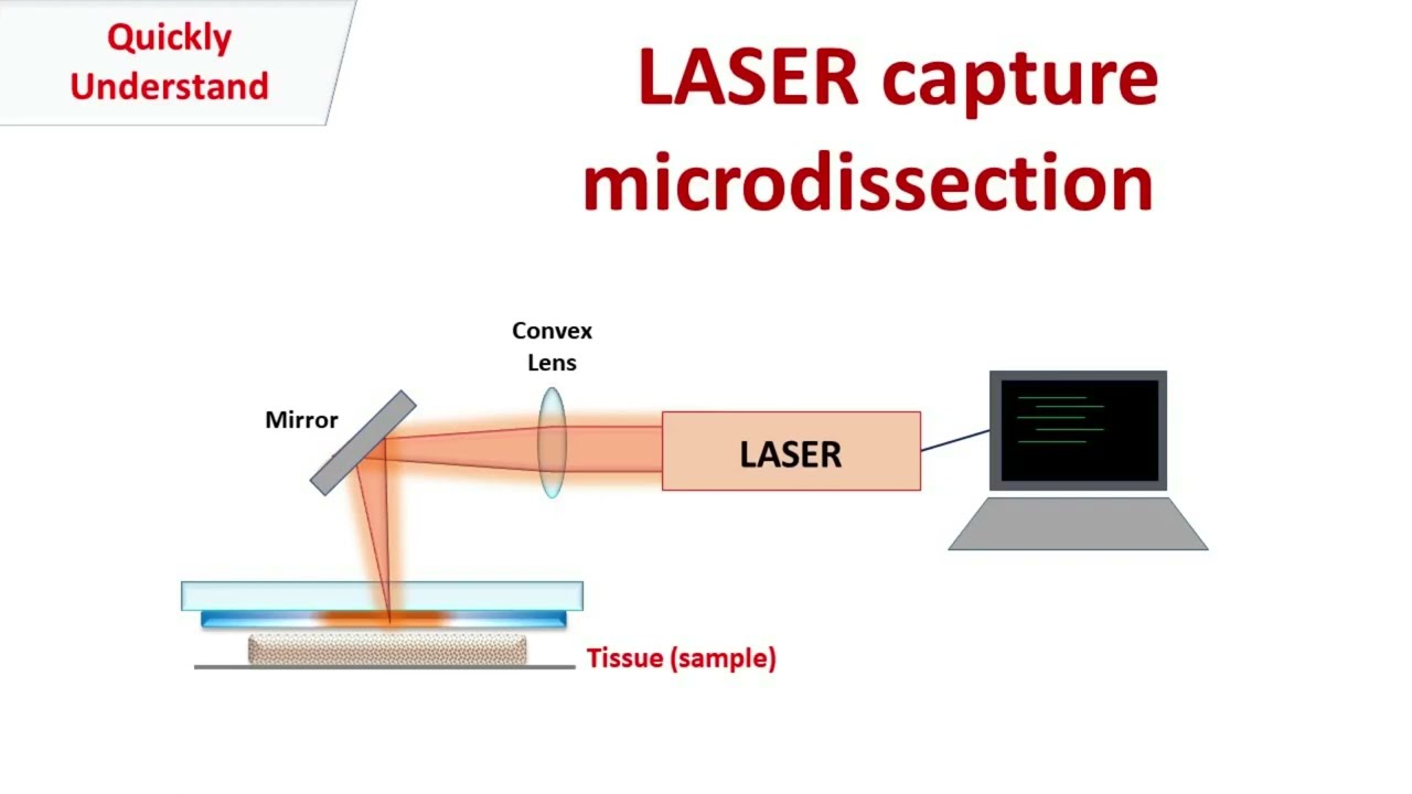 Laser capture microdissection - YouTube