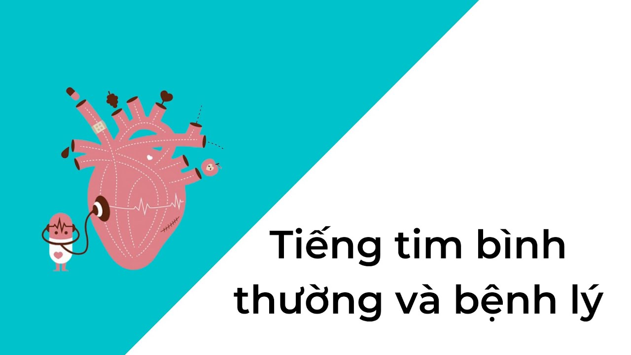 Một số tiếng tim bất thường hay gặp ( T2 tách đôi, T2 mờ, T1 đanh ...