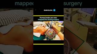 This AR Tech Makes Brain Surgery Feel Like Sci-Fi #braintech #neurotech #neurotechnology #viral