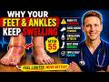 Swollen Feet, Swollen Ankles &amp; Swollen Legs [FIX Them FAST!]