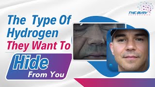Hydrogen’s Miraculous Healing Effects With Greg ‘The Hydrogen Man’