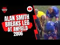 Alan smith breaks leg at anfield 2006