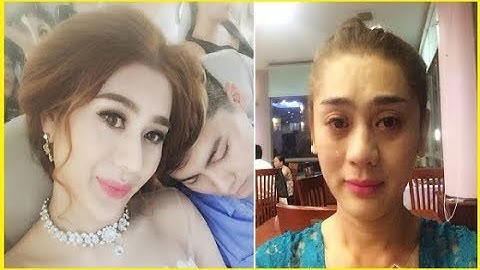 Rớt nước mắt với nỗi đau quặn thắt của 'Lâm Chí Khanh' sau đám cưới thế kỷ