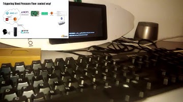 Amazon Web Services and e-health: Greengrass, Lambda, alexa, polly, dynamoDB, RaspberryPI