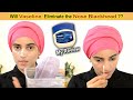 Does VASELINE Remove Nose BLACKHEADS & CLOGGED PORES ?? (by MisoJeong)    ll   My Honest Review