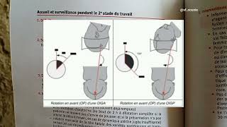 Obstétrique physiologique : les 3 stades du travail (accouchement normal)