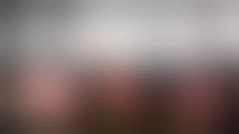 Uniportal VATS Right Basal Segmentectomy (the case with severe emphysema)　単孔式胸腔鏡下右肺底区切除術