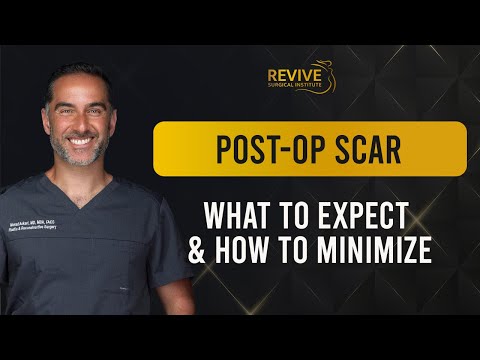 Post-Op Scarring: What