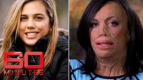Turia Pitt was burned alive during an ultra-marath...