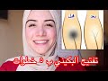 تفتيح البكيني فقط  | اهم  ٥ خطوات لتفتيح منطقة البكيني