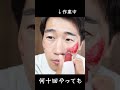 ダーマペンやりまくってクレーター肌は治せたのか？ #shorts