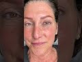 Microblading