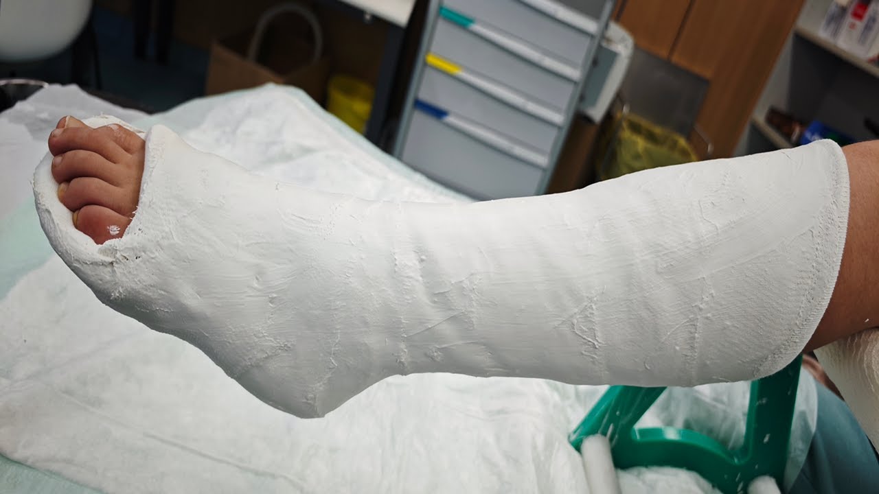 Come si applica uno stivaletto gessato in equino: tecnica passo per passo