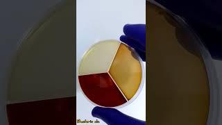 examen cytobacteriologique de prélèvement doreille  ماهي الاوساط الزراعية التي نستعملها؟