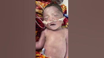 After birth premature baby on oxygen #premature #newbornbaby #miraclebaby #baby #cute #newborn
