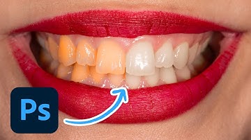How To Whiten Teeth In Photoshop (Best Way!)
