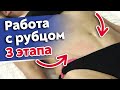 Как работать с рубцом массажисту? / Рубцовая ткань и её последствия на тело человека