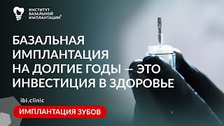 Как сохранить деньги на долгие годы? Инвестиции в здоровье и красоту улыбки — базальная имплантация.