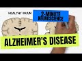 2 Minute Neuroscience Alzheimer S Disease 2 Minute Neuroscience Alzheimer S Disease