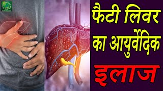 फैटी लिवर का आयुर्वेदिक इलाज | Ayurvedic Treatment of Fatty Liver @LOTUS AYURVEDA INDIA