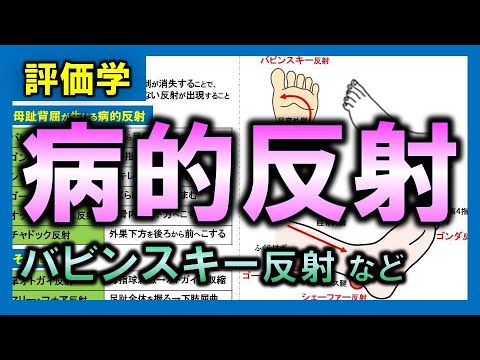 Evaluation] Pathological Reflex [Members Only] - YouTube