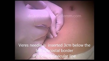 palmer´s point edited