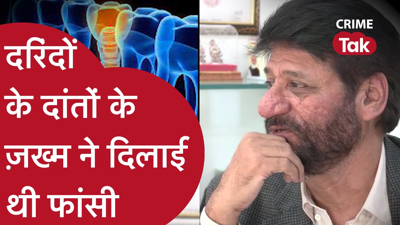 NIRBHAYA की कहानी, जांच अधिकारी की जुबानी। फॉरेंसिक हिस्ट्री में पहली बार डेंचर कास्ट बना था सबूत