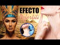 Efecto NEFERTITI 👸🏻 CUELLO Hermoso y Rejuvenecido SIN BISTURÍ 😍 BOTOX 🌹 DR ALBERTO CALVO