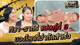 ทิวา-ราตรี แฝดคู่ที่ 3 ของโลก ที่ผ่าตัดสำเร็จ | Talk ในตำนาน S3 : EP 4