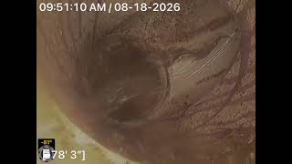 August 18, 2026/ 315 Meadowcroft LaneTimonium, Maryland 21093/ part 2