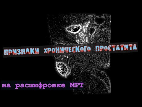 Видео: Задно изместване на пикочния мехур при котки