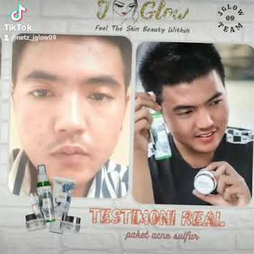 testimoni real j glow