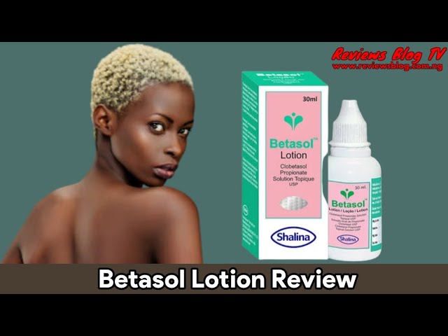 Ni dommer præst Betasol Lotion Review: The Best Treatment Oil For All Skin Types - YouTube