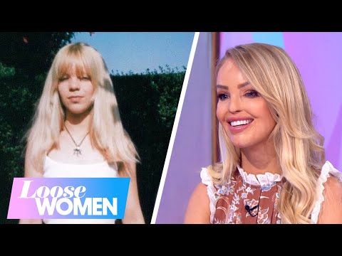 Katie Opens Up About Her Childhood & Life After Her Horrific Acid Attack | Life Before Loose | LW