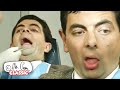 Bean at the DENTIST | Mr Bean Funny Clips | Classic Mr Bean