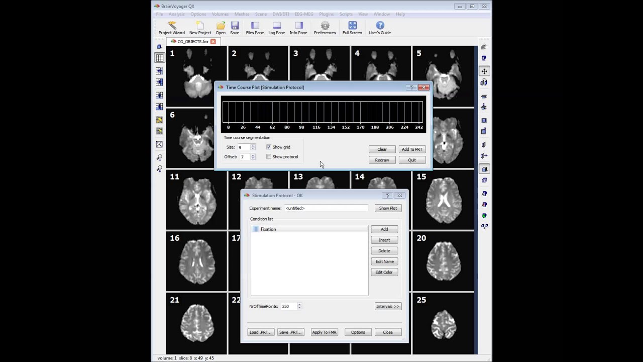 brain voyager analysis