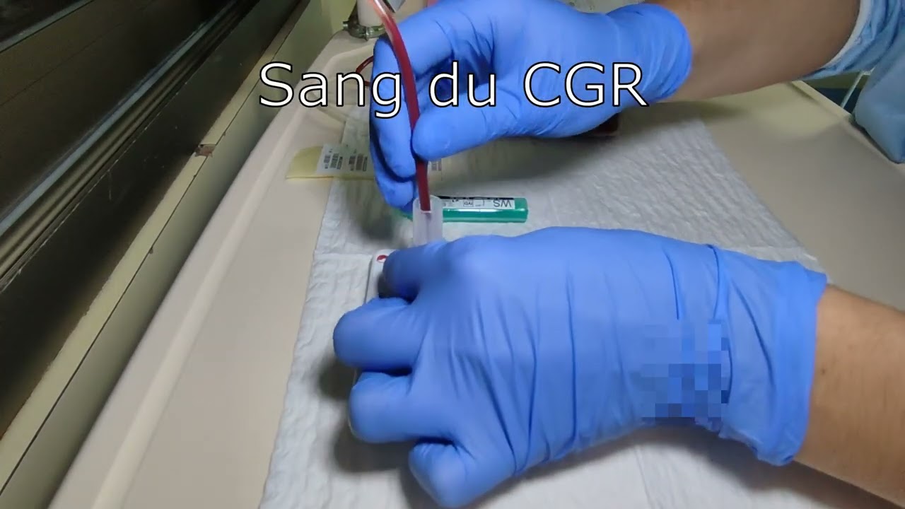 Tuto | Le carton-test, contrôle ultime pré-transfusionnel