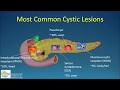 Natural History of Pancreatic Cysts: What Becomes of Them?