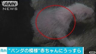 “パンダの模様”がうっすらと　赤ちゃんスクスク(17/06/20)