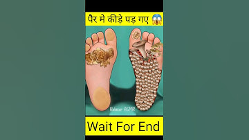 पैर मे कीड़े पड़ गए 😱|3d animation | 3d animation | ai news|ai tool | #ai tool #youtube #shorts