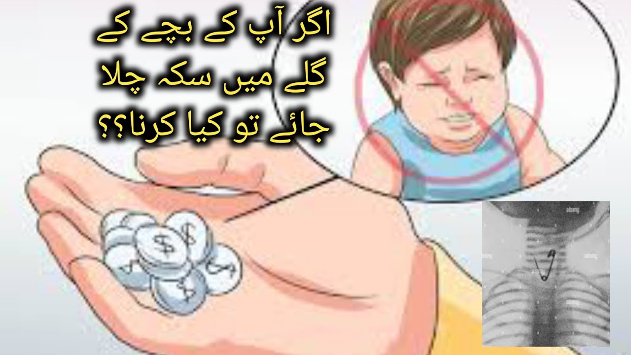 اگر آپ کے بچے کے گلے میں سکہ چلا جائے تو کیا کرنا؟؟ / coin's stuck in