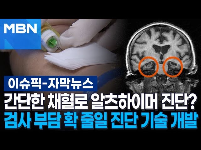 [자막뉴스] 간단한 채혈로 알츠하이머 진단?…검사 부담 확 줄일 진단 기술 개발 | 이슈픽
