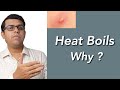 Heat Boils - Why ?