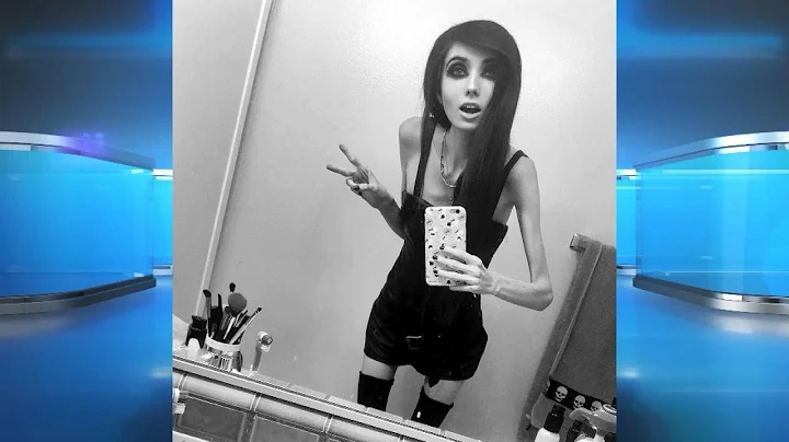 Social Media Star Accused of Anorexia