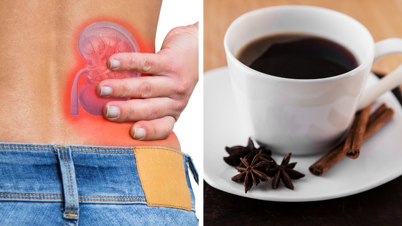 Star Anise Coffee A Natural And Effective Treatment For Kidney Stones